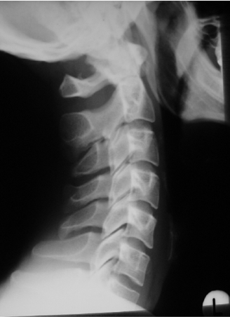 Röntgendiagnostik